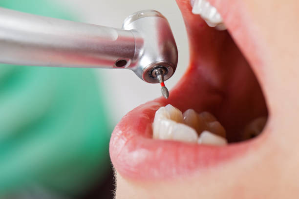 Best Emergency Dental Care for Trauma or Injury in Ukiah, CA